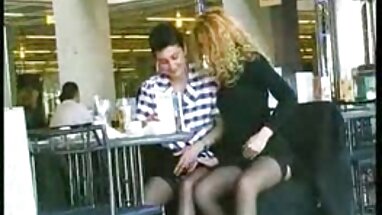 sưng séc người béo